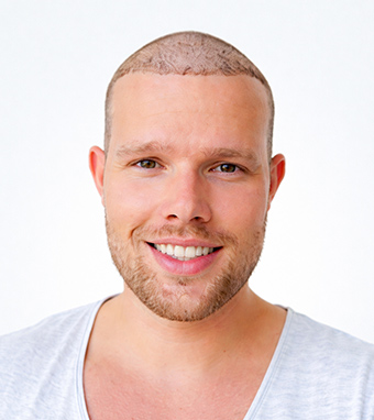 Alex – Tag 1 nach OP